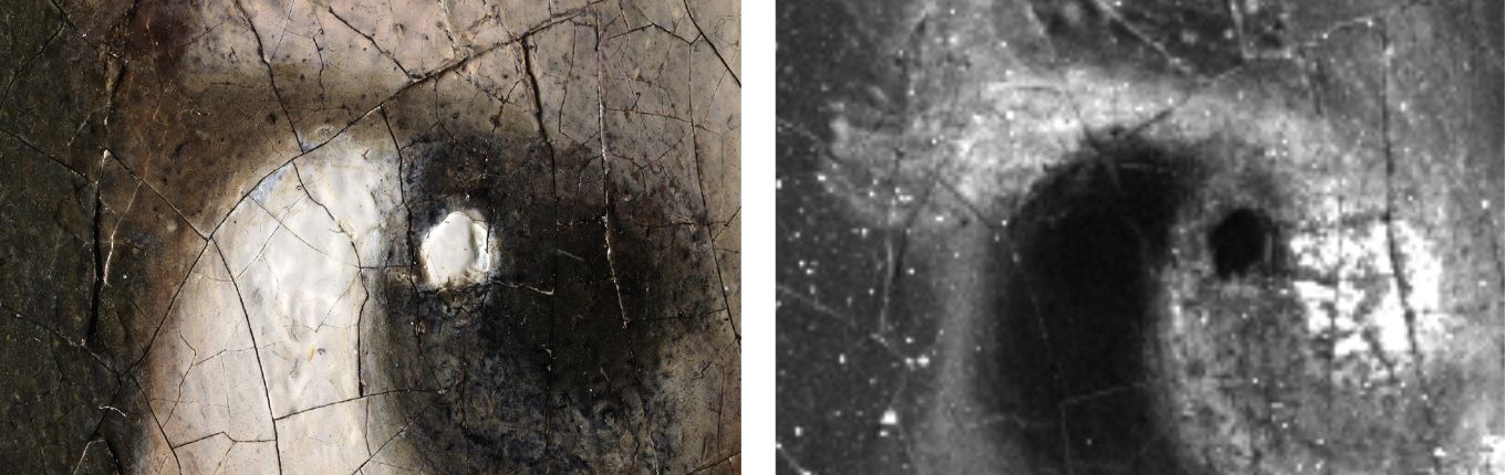 3D digital microphotograph of the Girl’s right eye: 140x magnification. 3D digital microphotograph of the Girl’s right eye: 140x magnification.